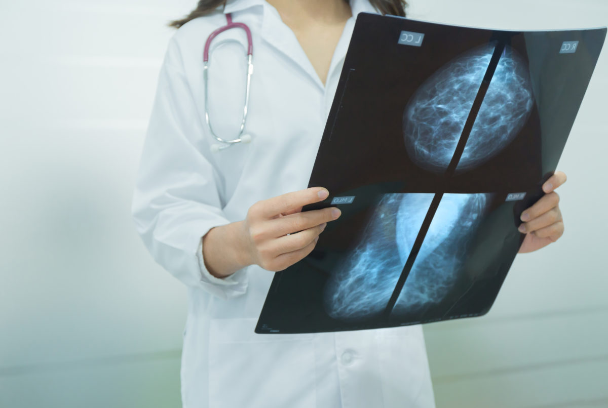 radiologist examining mammogram